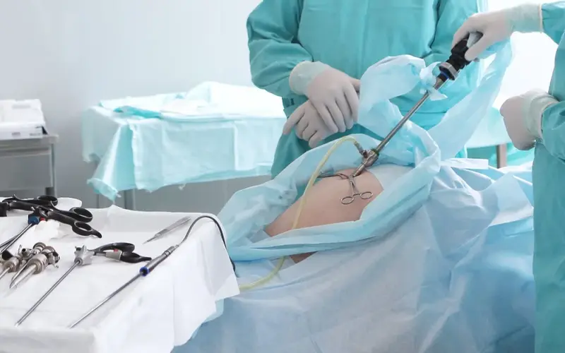 Phẫu thuật túi mật và ruột thừa chỉ với một vết rạch giấu kín, không sẹo: Định nghĩa lại nhận thức về phẫu thuật